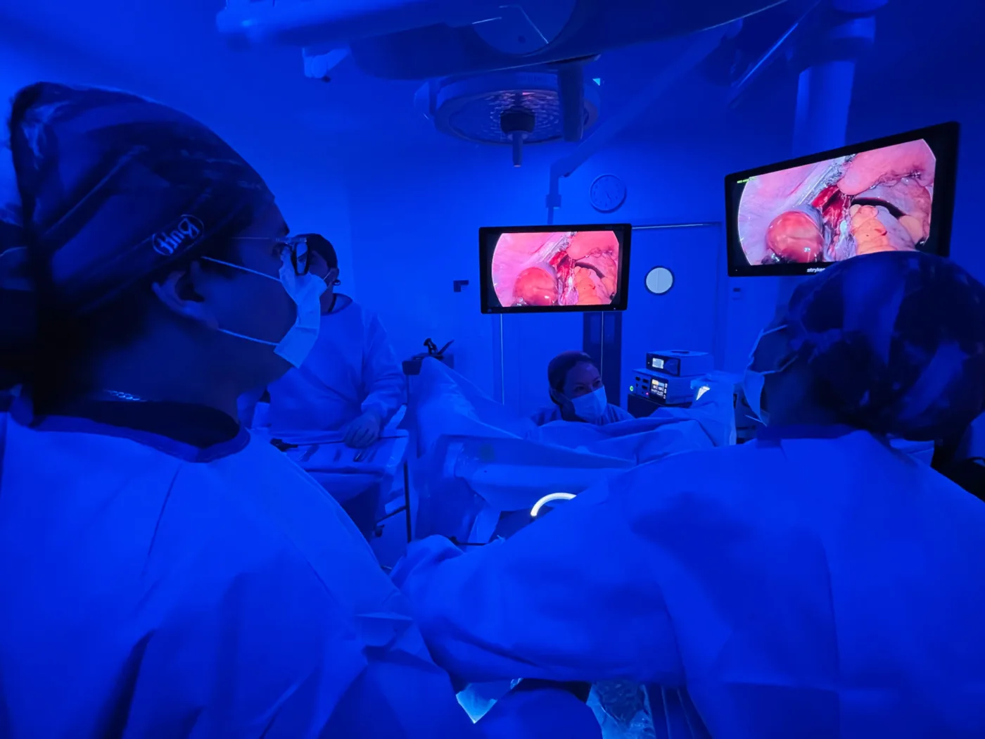 Monitores de alta definición utilizados durante una laparoscopia ginecológica