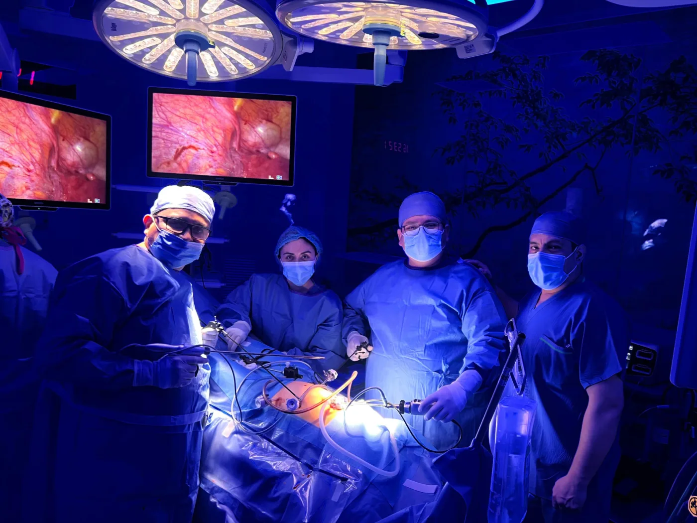 Equipo quirúrgico durante un procedimiento de laparoscopia ginecológica